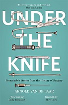 Under the Knife