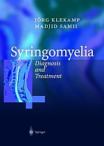 Syringomyelia