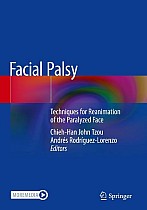 Facial Palsy